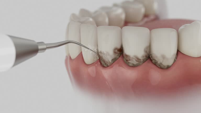 Reliable Emergency Dentist contractor in Perry County County, OH by Dentist Open Now
